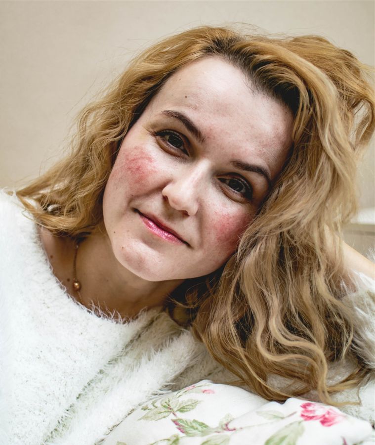 Petra svabikova rozsacea